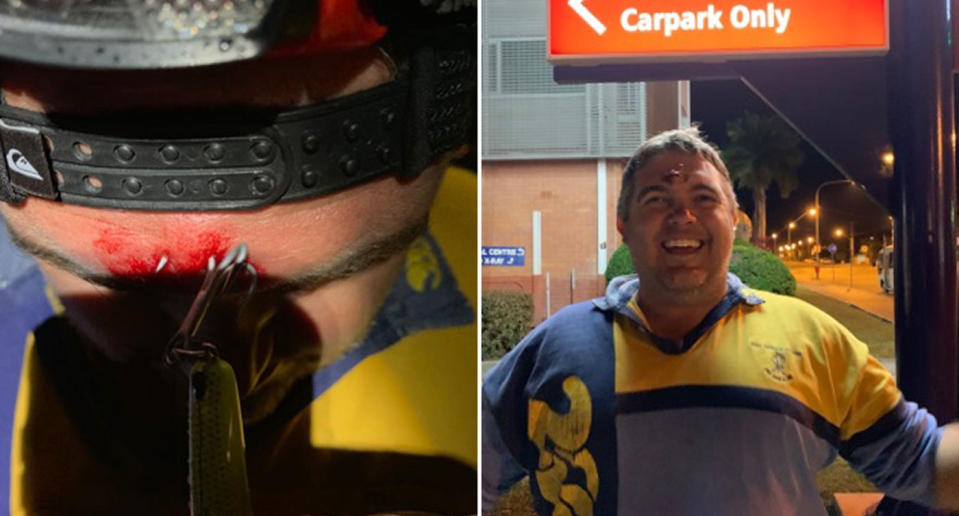 Townsville fisherman Brad Simmons with a fishing hook in his head and pictured standing in front of hospital smiling.