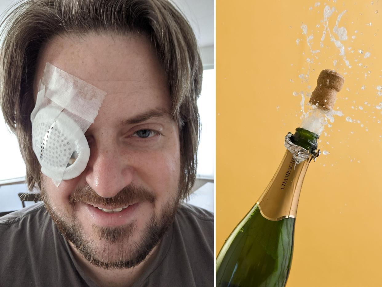 Jeremy West wearing an eye guard after popping a champagne cork into his eye.