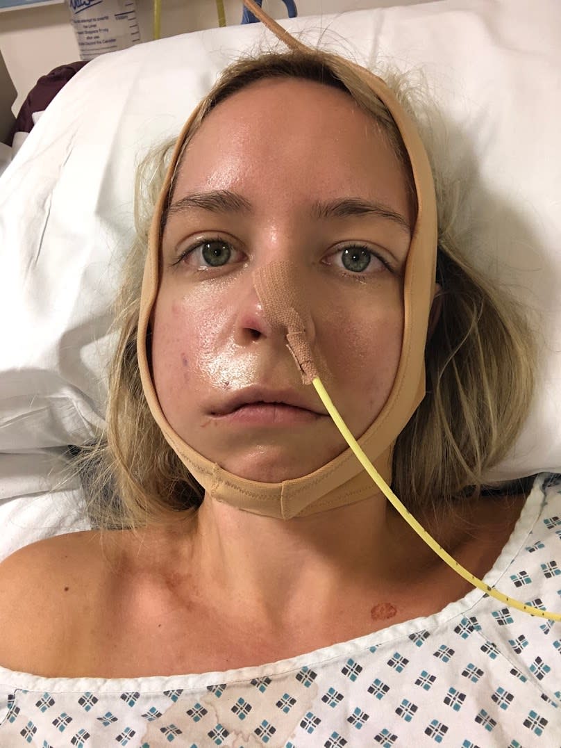 Ms Taylor underwent the first surgery of her kind in the UK to fix her facial paralysis.