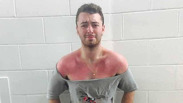 It's safe to say Sam Smith has kept the weight off and then some. The 23-year-old British singer was in Miami recently, but his painful looking sunburn wasn't the only thing that had jaws dropping -- this is the skinniest we've ever seen the "Lay Me Down" singer since he started losing weight earlier this year. "My sun burn is SO BAD �������� Lobster viiiiiiiibes �� Just had to make this top to give it some air hahhaaaaa Lord," he wrote. <strong>WATCH: Sam Smith Admits Someone Calling Him Fat Hurts Him More Than Anti-Gay Slurs</strong> Check out how handsome Smith's looking these days! Even the GRAMMY award winner himself is impressed with the incredible weight loss he's achieved in the last year alone. Smith has credited Amelia Freer, a nutritional therapist and author of <em>Eat. Nourish. Glow.: 10 Easy Steps for Losing Weight, Looking Younger & Feeling Healthier</em>, for his incredible results. "2014 - 2015 -- a lot has changed haha," he acknowledged last week with these before and after photos. Perhaps Smith is extra motivated these days to stay on the fitness track, given his new collaboration with Balenciaga on their upcoming Fall/Winter 2015 campaign, which he just announced last week. <strong>WATCH: Sam Smith Responds to Howard Stern Calling Him Fat & Ugly</strong> In April, Smith candidly admitted that someone calling him fat actually affects him more than anti-gay slurs. "If someone called me fat, that affects me way more than someone calling me a f----t," he admitted to Australia's <em>60 Minutes</em>. "I think just because I've accepted that, if someone calls me a f----t, it's like, I am gay and I'm proud to be gay so there's no issues there. If something calls you fat, that's something I want to change." Watch below: