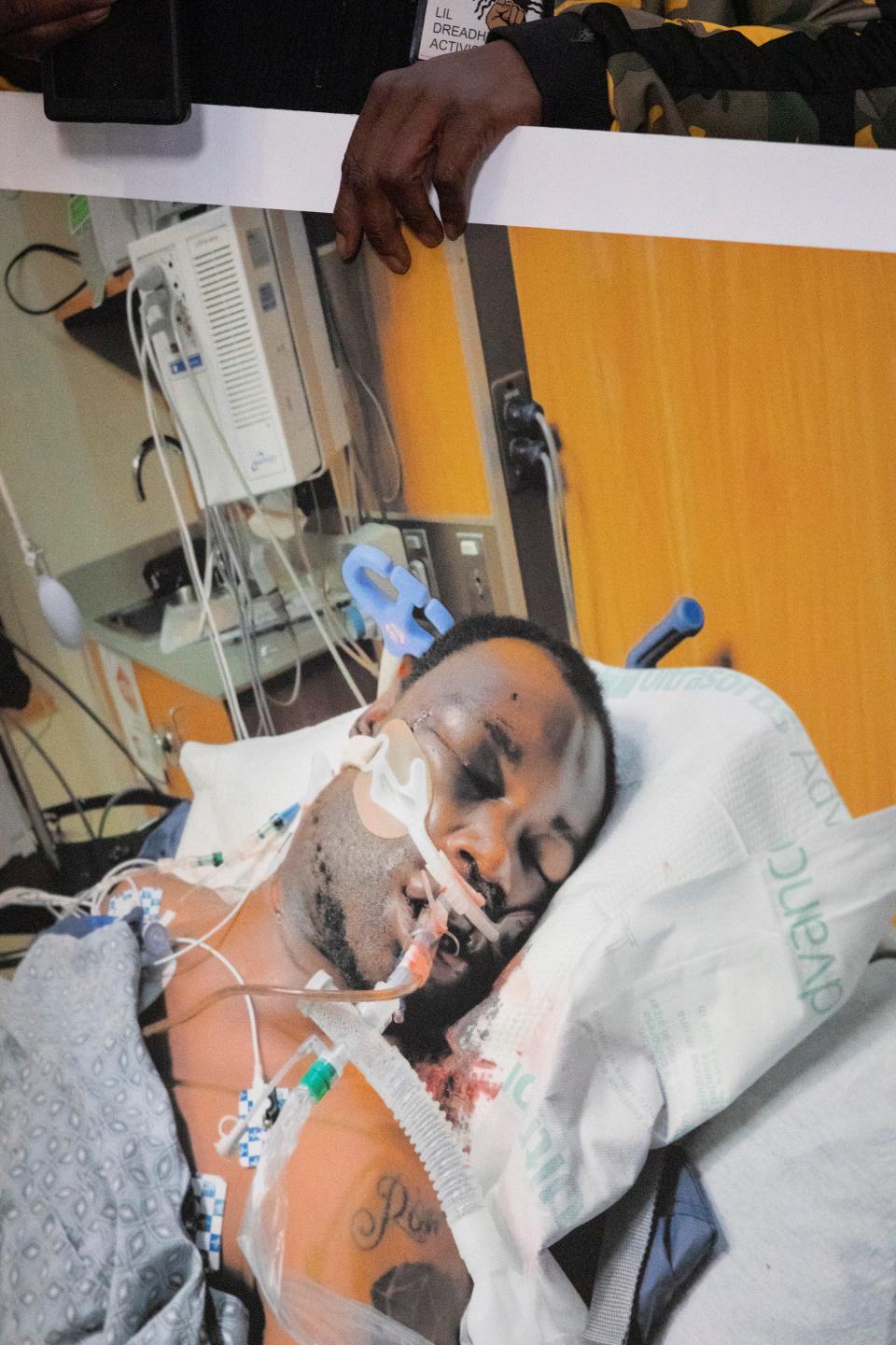 A family member of Tyre Nichols holds a photo of him in the hospital in critical condition after the traffic stop during a press conference at Mt. Olive Cathedral CME Church in Memphis, Tenn., on Monday, January 23, 2023. 