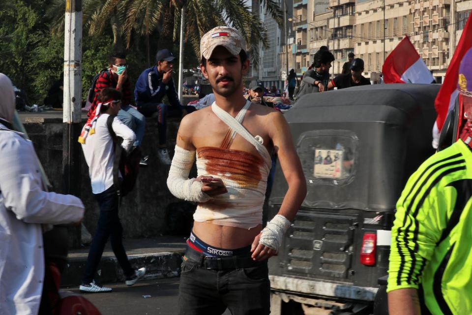 After receiving hospital treatment, a wounded protester returns to Tahrir Square during ongoing anti-government demonstrations in Baghdad, Iraq, Thursday, Oct. 31, 2019. (AP Photo/Hadi Mizban)