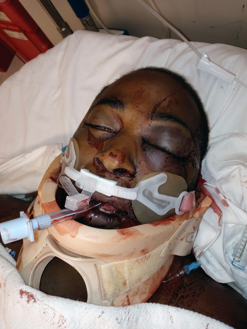 This photo provided by Monica Lee shows her son, Damien Montrell Cameron, 29, in a Mississippi hospital after his arrest by Rankin County sheriff's deputies on Monday, July 26, 2021. The family is blaming his death on alleged excessive force by Deputies Hunter Elward and Luke Stickman. (Courtesy Monica Lee via AP)