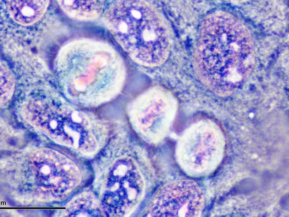 Dividing HeLa cells in culture