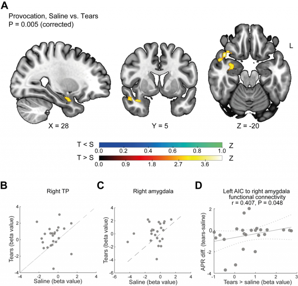 研究人員進行了一項功能性磁共振成像（fMRI）的研究，比較男性受試者在聞到眼淚和鹽水（對照組）時的大腦活動。這項研究是為了了解眼淚是否對大腦中與攻擊行為相關的區域產生影響。 主要發現：當參與者聞到眼淚而非鹽水時，大腦中與情緒和攻擊性相關的區域，如前額葉皮層（特別是左前導皮層）和右邊的杏仁核之間的連接性減弱。這表明眼淚中的化學物質可能減少了與攻擊性相關的大腦活動。（圖／《PLOS Biology》）