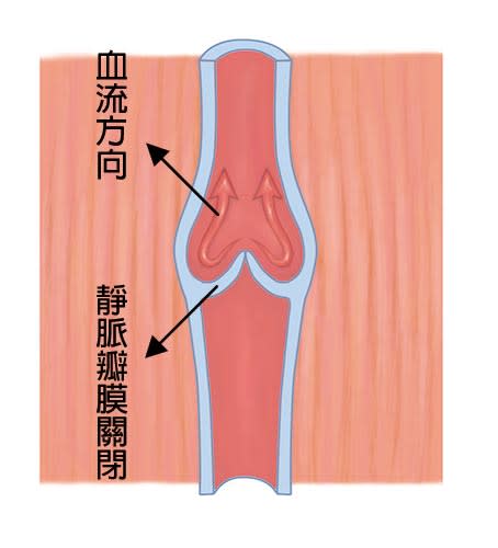 正常的靜脈瓣膜開合，能導引血液單方向流動