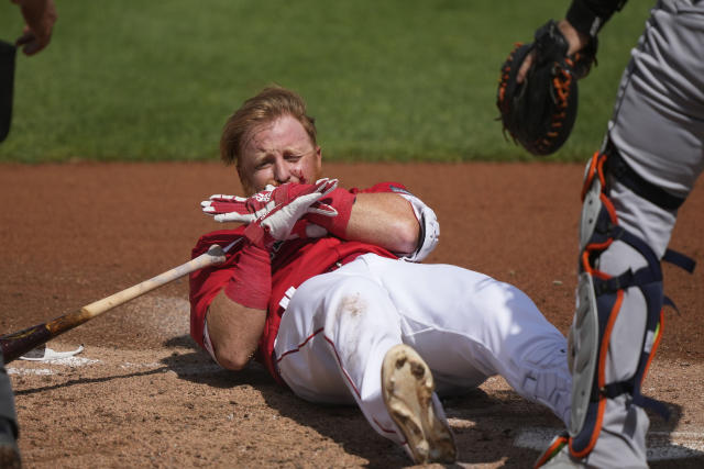 After being hit in face by pitch, Red Sox' Justin Turner tweets: 'I'm going  to be back out on the field as soon as possible!' – Blogging the Red Sox