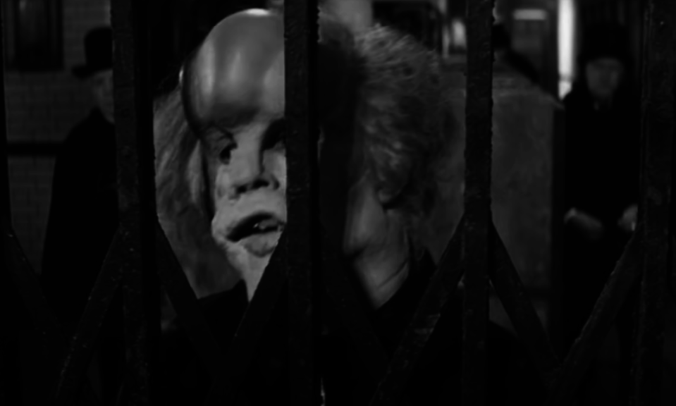 Screenshot from "The Elephant Man"