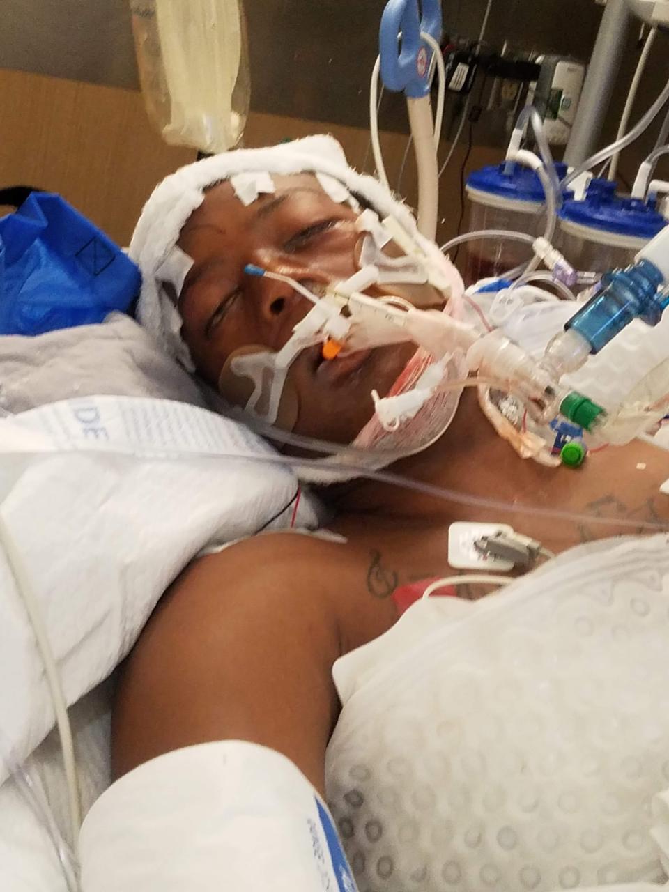 Elijah McClain is shown in a hospital bed before he died in 2019 following a violent encounter with police in Aurora, Colorado.