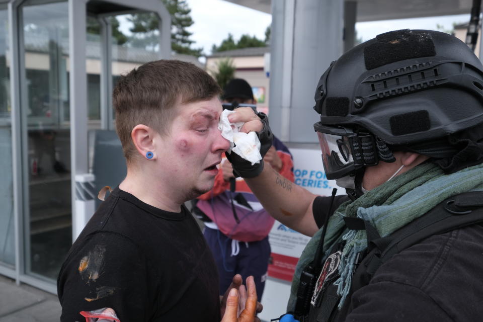 An anti-fascist protester receives medical attention after getting hit in the face with a paintball round fired by members of the far-right group Proud Boys as the two groups clashed in Sunday, Aug. 22, 2021, in Portland, Ore. (AP Photo/Alex Milan Tracy)