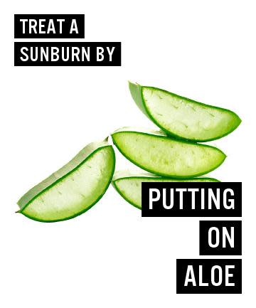 Sunburn remedy with yogurt and aloe vera