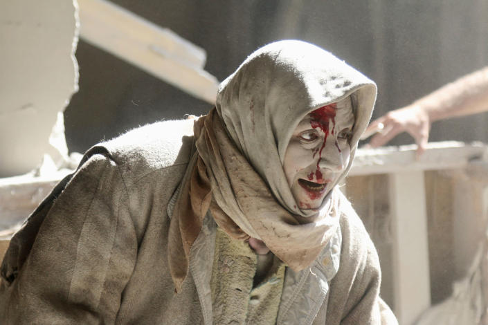 <p>APR. 28, 2016 — An injured woman reacts at a site hit by airstrikes in the rebel held area of Old Aleppo, Syria. (Abdalrhman Ismail/Reuters) </p>