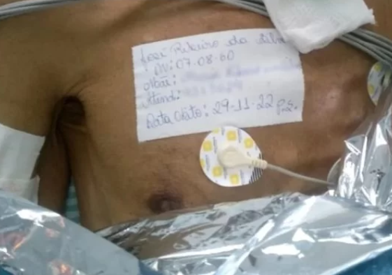 巴西口腔癌患者達席爾瓦被醫師誤宣判死亡，醫師事後遭到院方解雇。（翻攝推特@Metropoles）