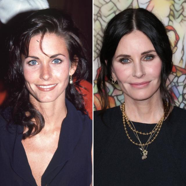 Plastic Surgery Gone Wrong: Celebs Who Regret Going Under the Knife and  Other Cosmetic Procedures