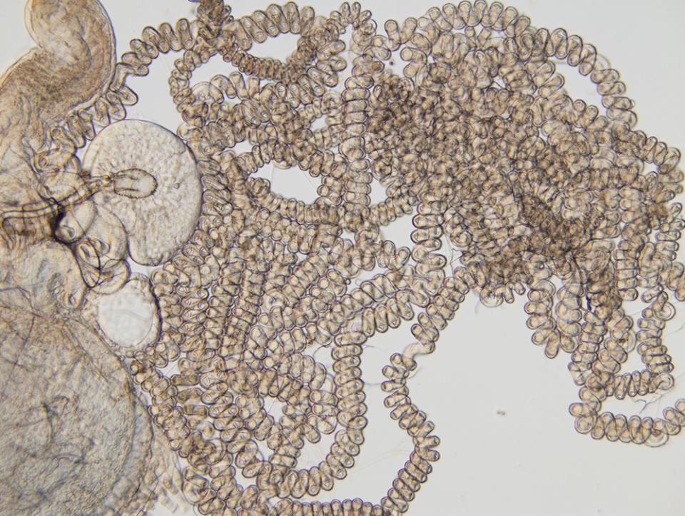 The sperm-storage tubule of the fruit fly <em>Drosophila bifurca</em> is nearly 8 centimeters long. The size of this organ drives the size of mega sperm in males.