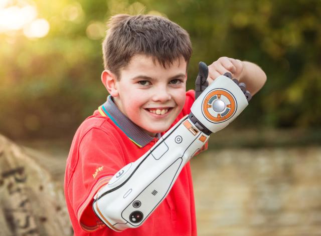 Open Bionics' 3D-printed prosthetic arm is now available in the US