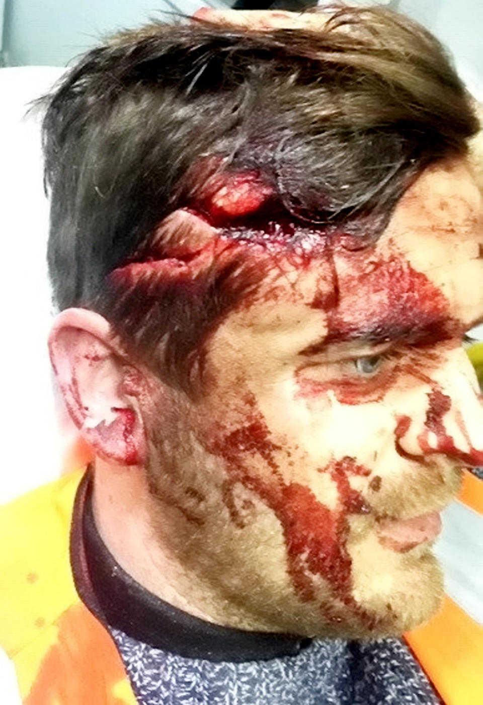 A 10kg tow bar smashed through his windscreen and hit him in the head (Picture: SWNS)