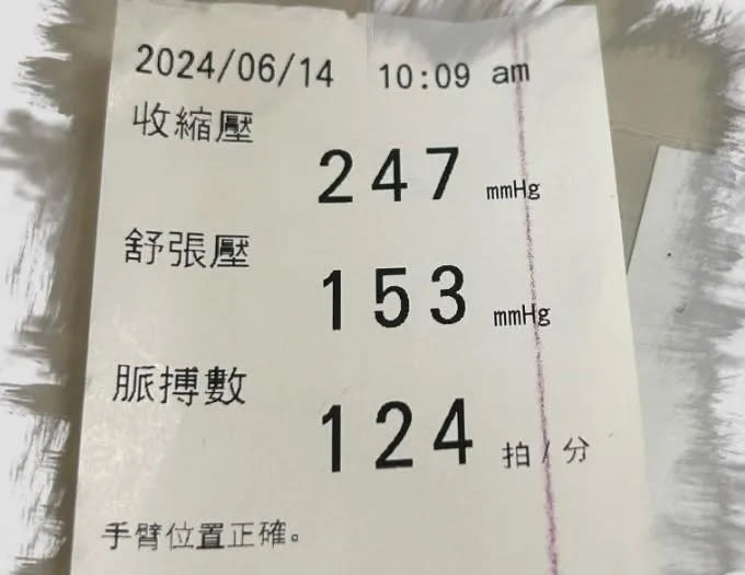 <strong>該患者就醫時收縮壓247 mmHg、舒張壓153 mmHg、脈搏數每分鐘124拍。（圖／</strong><a href="https://www.facebook.com/garychen19801025?__tn__=-UC*F" rel="nofollow noopener" target="_blank" data-ylk="slk:冠任醫師的異想世界;elm:context_link;itc:0;sec:content-canvas" class="link "><strong>冠任醫師的異想世界</strong></a><strong>）</strong>