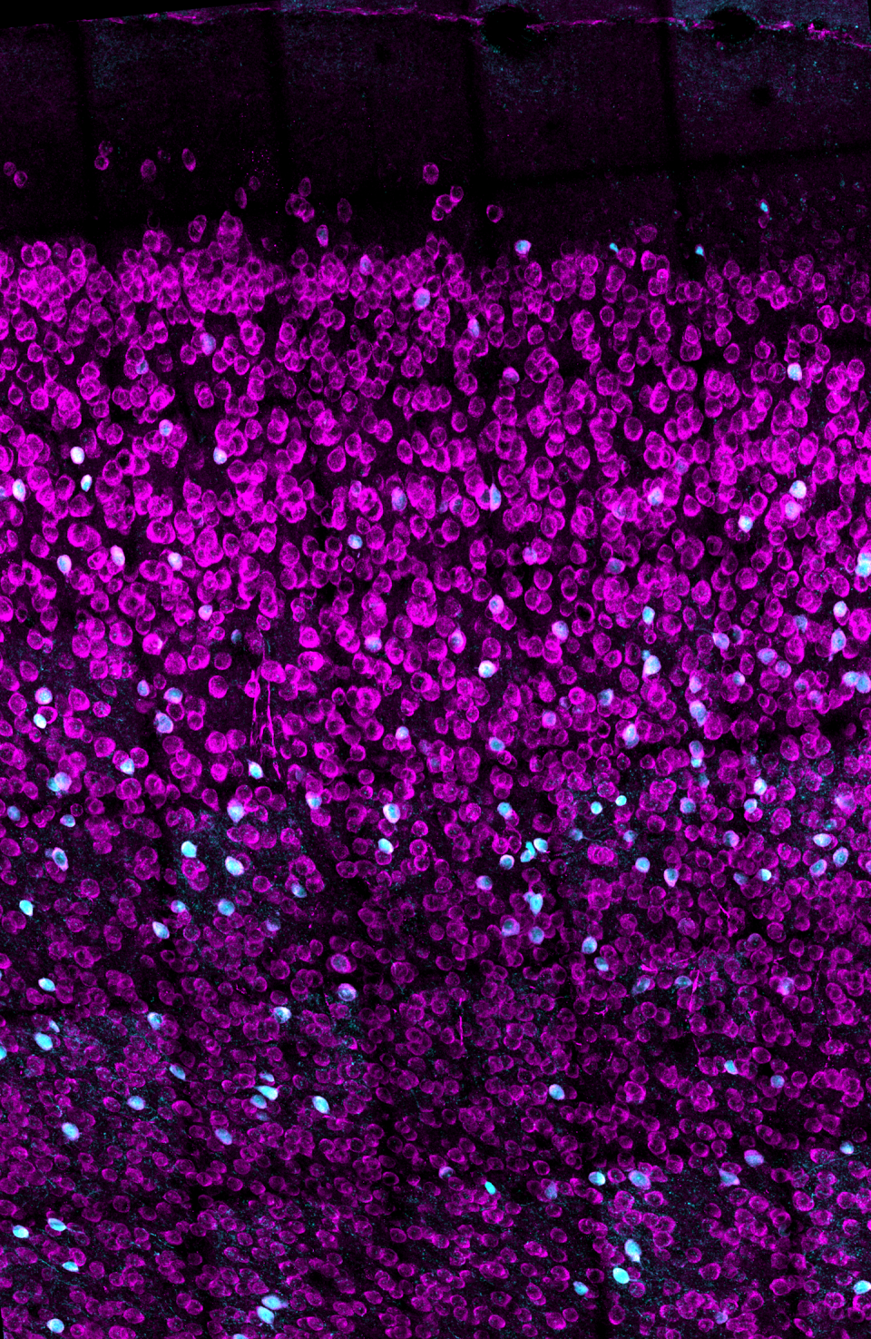 Image of hormone receptors in the prefrontal cortex of the brain, lit up in different colors.