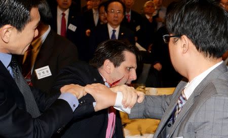 U.S. Ambassador to South Korea Mark Lippert leaves after he was slashed in the face by Kim Ki-jong, a member of a pro-Korean unification group, at a public forum in central Seoul in this handout picture provided by Munhwa Ilbo on March 5, 2015. REUTERS/Munhwa Ilbo