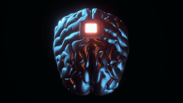 Picture of a chip in the brain.