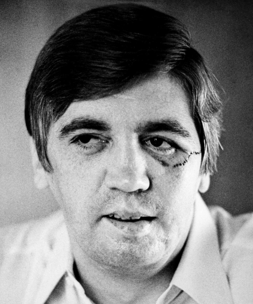 Former McNairy County Sheriff Buford Pusser talks about his life on Aug. 1, 1973, as the six anniversary of having his jaw shot off and his wife killed in a dawn ambush Aug. 12. His face bears the scars of many such battles. But not long after that, people stopped shooting at him and started singing, writing books and making movies about him, making him a folk hero.