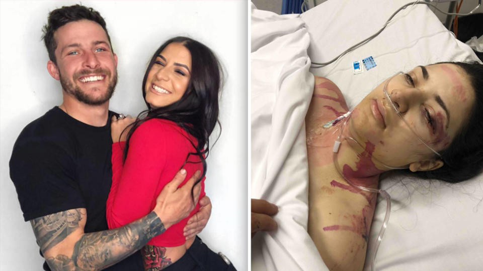 Christina is now recovering in the Royal Adelaide Hospital with her fiancé, James, by her side. Images: Facebook/Christina Vithoulkas & GoFundMe