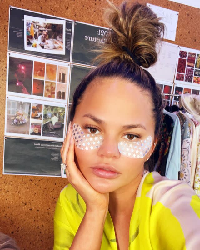 <p>Botox isn't just for aesthetics. Teigen took to <a href="https://twitter.com/chrissyteigen?ref_src=twsrc%5Egoogle%7Ctwcamp%5Eserp%7Ctwgr%5Eauthor" rel="nofollow noopener" target="_blank" data-ylk="slk:Twitter;elm:context_link;itc:0;sec:content-canvas" class="link ">Twitter</a> to talk about her “really, really bad pregnancy headaches" and being “thrilled to be cleared to do neck muscle Botox along with a crazy combo of Beta Blocker shots.”</p><p>Teigen also has used Botox for another medical condition: excessive sweating. "Botoxed my armpits. Truly best move I have ever made. I can wear silk again without soaking woohoo!" she shared in a <a href="https://www.womenshealthmag.com/health/a28698867/chrissy-teigen-botox-armpit-sweat/" rel="nofollow noopener" target="_blank" data-ylk="slk:video on her social media in 2019;elm:context_link;itc:0;sec:content-canvas" class="link ">video on her social media in 2019</a>.</p><p><a href="https://www.instagram.com/p/CLZ_y89hnLI&hidecaption=true" rel="nofollow noopener" target="_blank" data-ylk="slk:See the original post on Instagram;elm:context_link;itc:0;sec:content-canvas" class="link ">See the original post on Instagram</a></p>