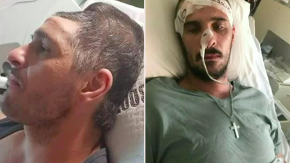 Paul Tsagaris’s family shared confronting pictures of his injuries after he was allegedly left for dead by a P-plate driver. Source: 7News