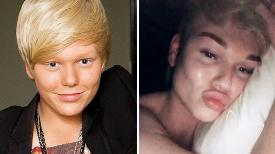 Jack Vidgen's transformation 