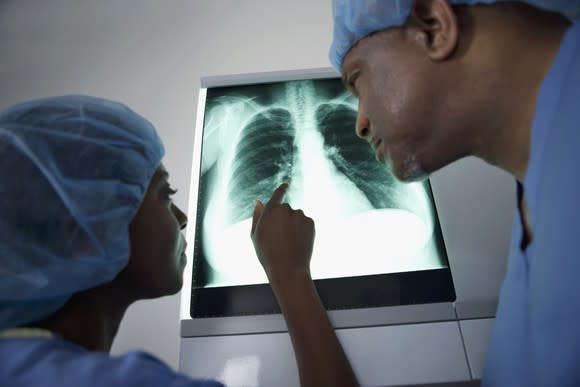 Surgeons examining a chest x-ray.