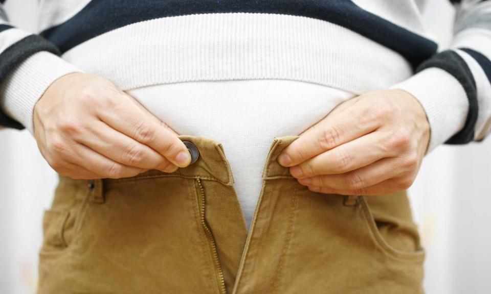 Man unable to close trousers over large stomach