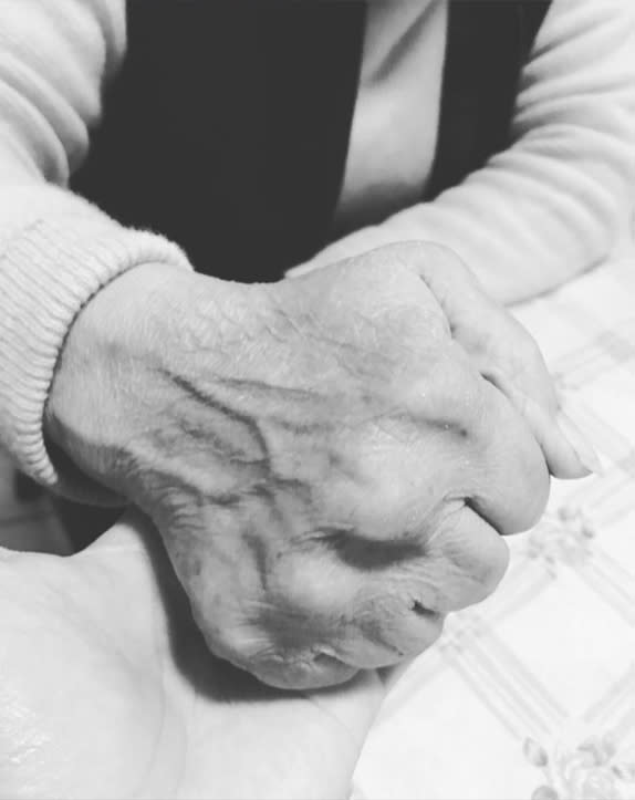 阿嬤長年慢性病變形的手。圖／波士頓藍人　攝影 