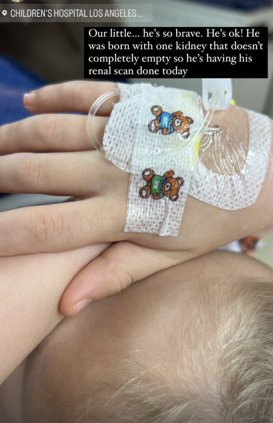 Tori Spelling's son hand with an IV. (@torispelling on Instagram)