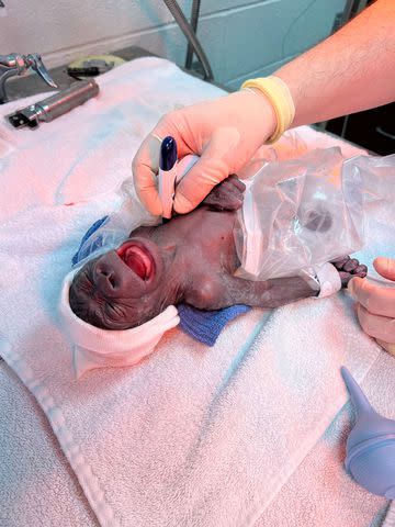 <p>TMX/fort Worth Zoo</p> Jameela, the premature gorilla born at the Fort Worth Zoo in January