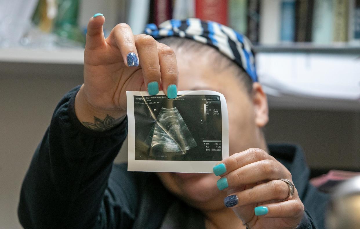 A patient seeking an abortion at Hope Medical Group for Women in Shreveport, La., holds up her ultrasound photo last year showing she is just over nine weeks pregnant. Despite mental health conditions making up more than 20% of maternal deaths and 1 in 5 women suffering maternal mental health conditions, several states explicitly exclude mental health conditions as exceptions to abortion restrictions.