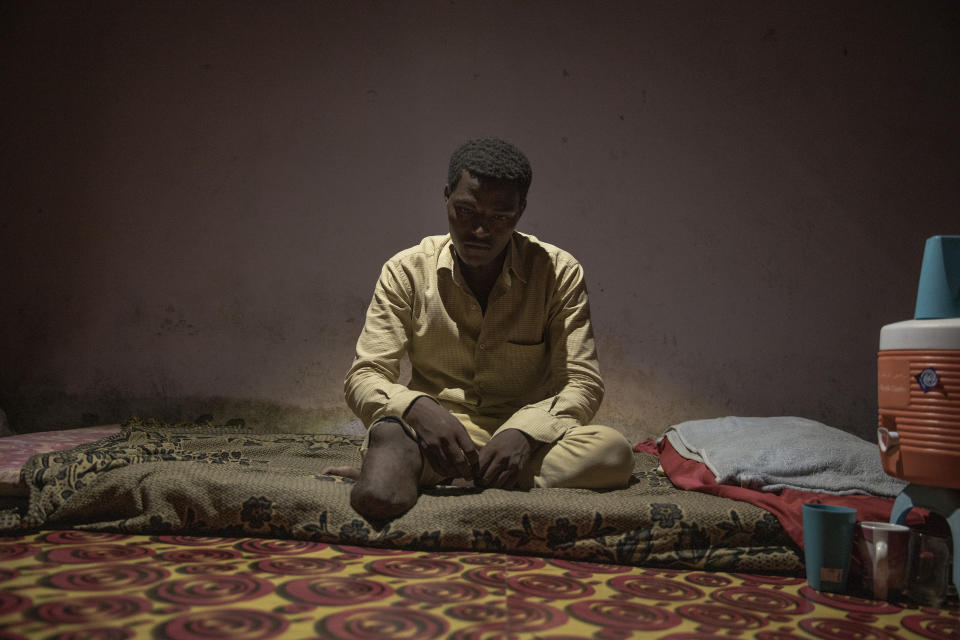In this July 20, 2019 photo, 17-year-old Ethiopian migrant Abdul-Rahman Taha, shows his amputated leg, at his home, in Basateen, a district of Aden, Yemen. When he landed at Ras al-Ara, traffickers took him and 50 other migrants to a holding cell, demanding phone numbers. Taha couldn't ask his father for more money so he told them he didn't have a phone number. One night, a captor beat his right leg with a steel rod. Taha passed out and was dumped in the desert with three dead migrants by traffickers. (AP Photo/Nariman El-Mofty)