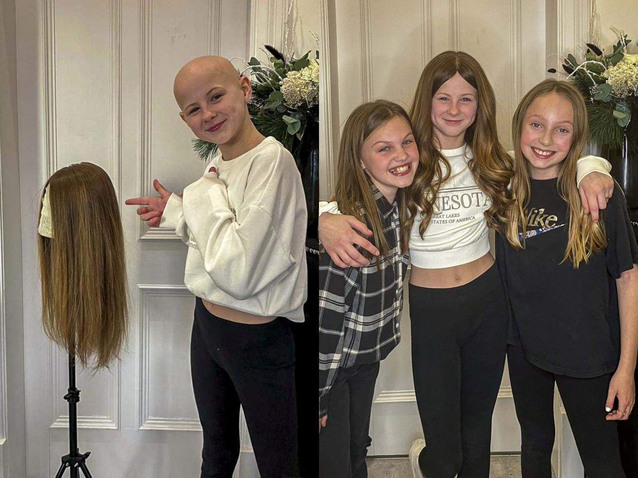 Bonnie Pullan, 11, has received life-changing hair loss treatment. (SWNS)