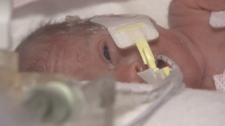 Parents of P.E.I. micro preemie Paizlee Rose say they gain strength, support through Facebook