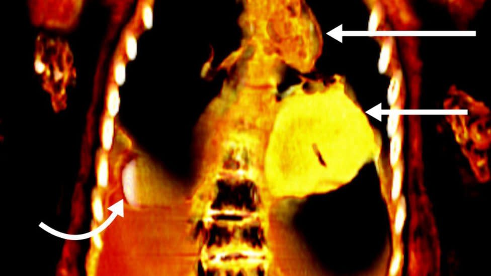 Imagen donde se ve el corazón de oro de la momia