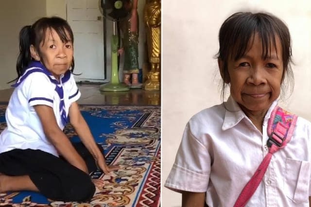 Schoolgirl, 10, looks like a 60-year-old woman due to rare ageing condition