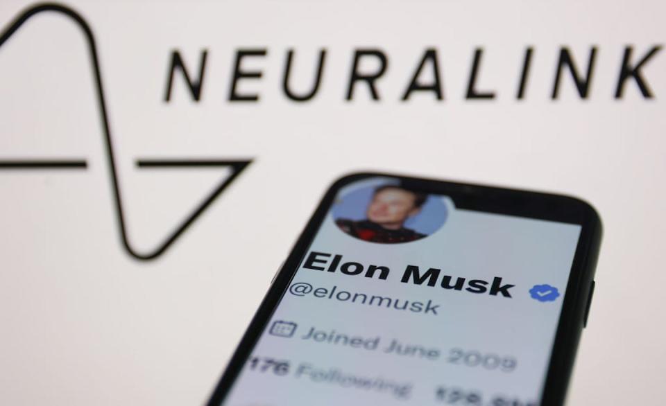 Neuralink’s first human implant was announced on Elon Musk’s social media platform X, formerly known as Twitter, in January 2024. <a href="https://www.gettyimages.com/detail/news-photo/elon-musk-account-on-twitter-and-neuralink-emblem-displayed-news-photo/1247138943?adppopup=true" rel="nofollow noopener" target="_blank" data-ylk="slk:NurPhoto via Getty Images;elm:context_link;itc:0;sec:content-canvas" class="link ">NurPhoto via Getty Images</a>