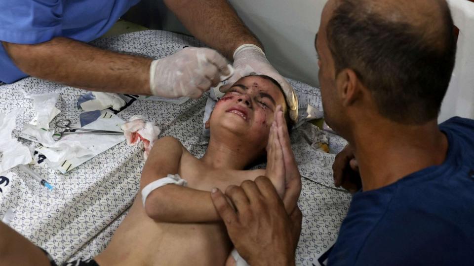 PHOTO: A boy is treated for injuries at a hospital in the city of Rafah, in the southern Gaza Strip, Oct.12, 2023, as battles between Israel and the Hamas movement continue for the sixth consecutive day. (Said Khatib/AFP via Getty Images)