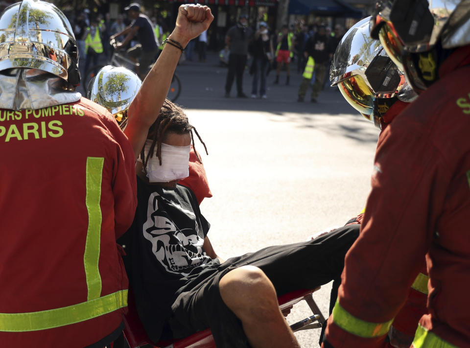 An injured man raises his fist as he is carried away by emergency personnel during a yellow vest demonstration in Paris, Saturday, April 20, 2019. French yellow vest protesters are marching anew to remind the government that rebuilding the fire-ravaged Notre Dame Cathedral isn't the only problem the nation needs to solve. (AP Photo/Francisco Seco)