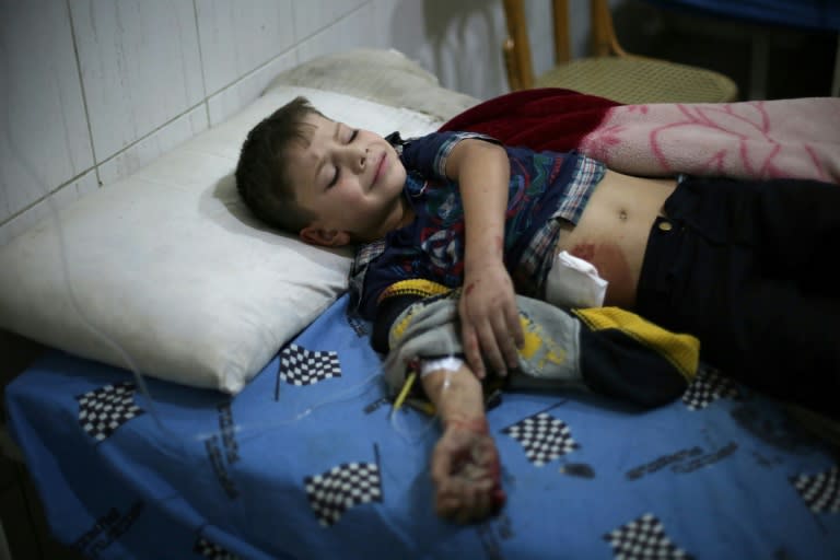 A Syrian child lies on a bed at a makeshift hospital following the reported government shelling of a school in the rebel-held besieged town of Jisreen, east of the capital Damascus, on October 31, 2017