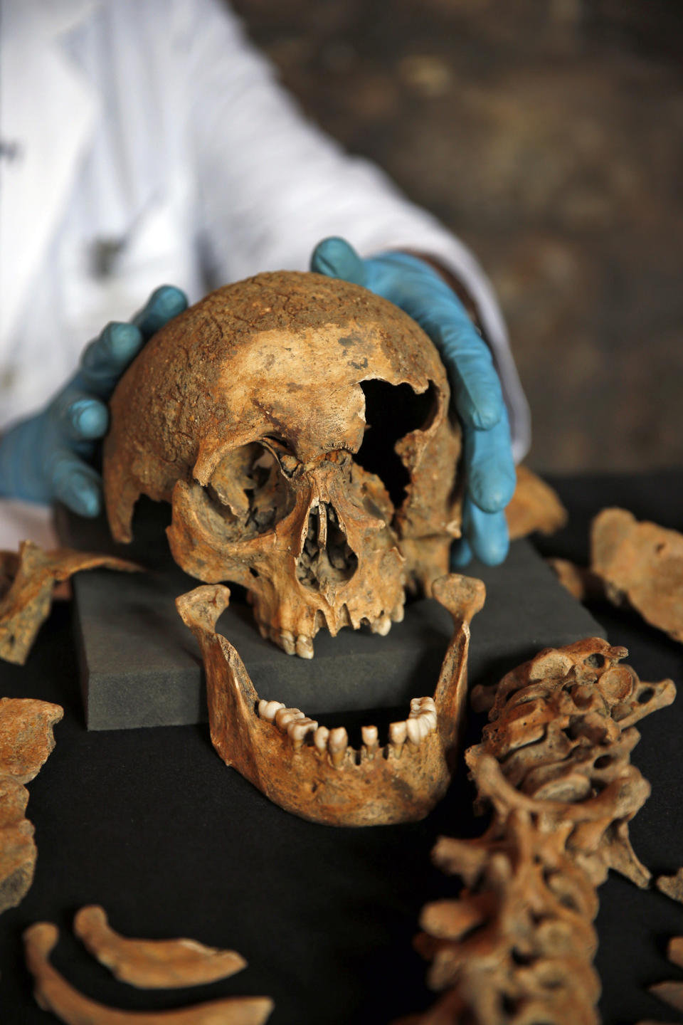 In this Wednesday, March 26, 2014 photo, Don Walker, a human osteologist with the Museum of London, holds the scull of one of the skeletons found by construction workers under central London's Charterhouse Square, as he poses for photographers. Twenty-five skeletons were uncovered last year during work on Crossrail, a new rail line that's boring 13 miles (21 kilometers) of tunnels under the heart of the city. Archaeologists immediately suspected the bones came from a cemetery for victims of the bubonic plague that ravaged Europe in the 14th century. The Black Death, as the plague was called, is thought to have killed at least 75 million people, including more than half of Britain's population. (AP Photo/Lefteris Pitarakis)