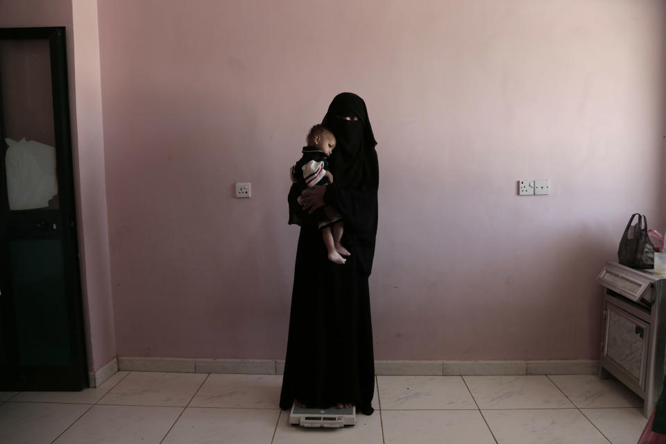 Umm Mizrah, a 25-year-old Yemeni woman, holds her son Mizrah on a scale in Al-Sadaqa Hospital in the southern Yemen city of Aden in this Feb. 13, 2018 photo. The woman, who is nearly into the second trimester of her pregnancy, weighed 38 kilograms (84 pounds), severely underweight. Mizrah, who was 17 months old, weighed 5.8 kilograms (12.8 pounds), around half the normal weight for his age. (AP Photo/Nariman El-Mofty)