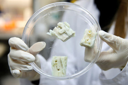 A researcher displays parts of a lab-grown, semi-liquid bone graft at the laboratory of Israeli biotech firm Bonus Biogroup in Haifa, Israel December 4, 2016. REUTERS/Baz Ratner