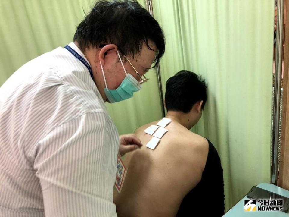 ▲李昌誠博士(左)進行三伏貼。（圖／朴子醫院提供 , 2018.07.20）