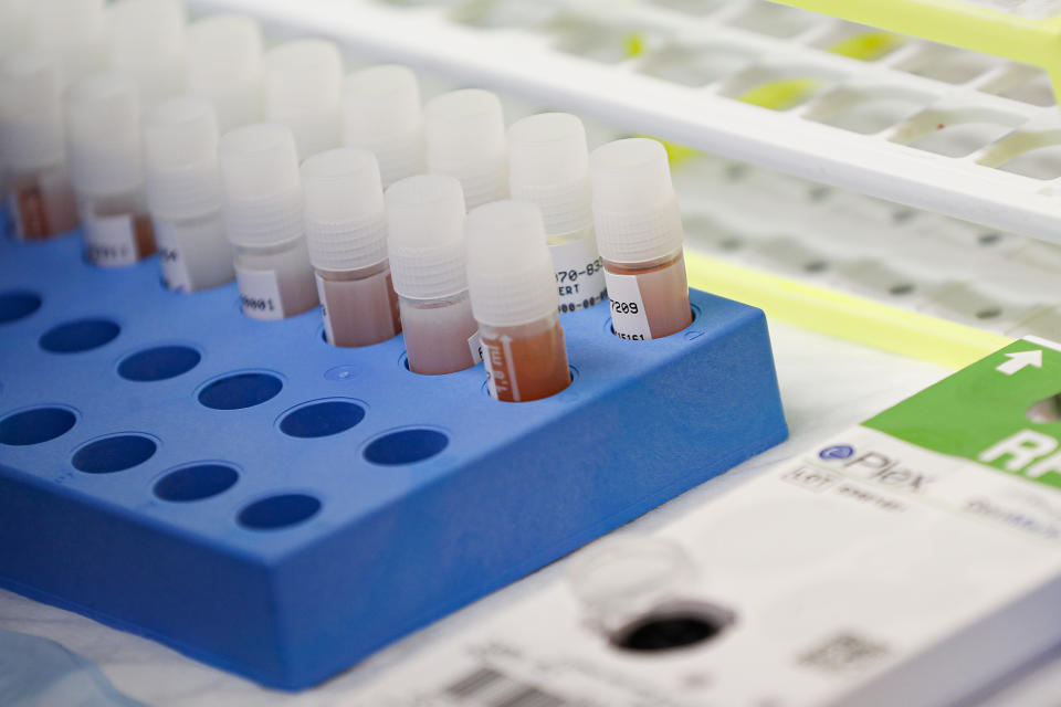 A laboratory technician prepares COVID-19 patient samples for semi-automatic testing at Northwell Health Labs, Wednesday, March 11, 2020, in Lake Success, N.Y. The US Food and Drug Administration has approved faster testing protocols as the viral outbreak continues to spread worldwide. For most people, the new coronavirus causes only mild or moderate symptoms. For some it can cause more severe illness. (AP Photo/John Minchillo)